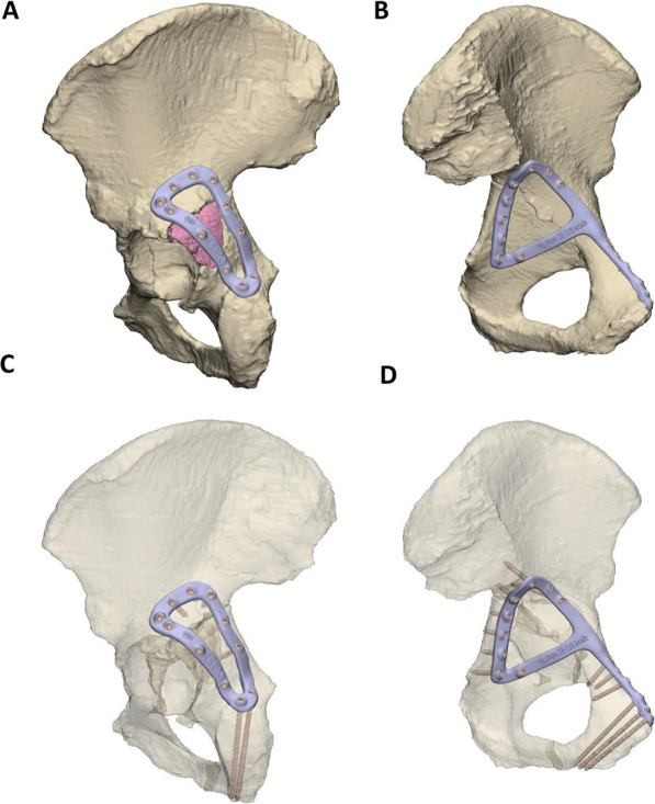 Fig. 2