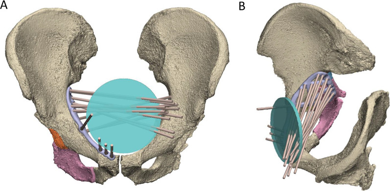 Fig. 11