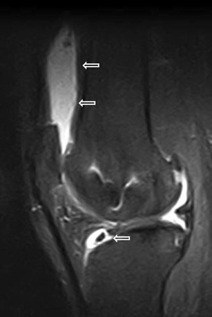 Fig. 18