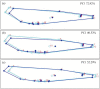 Fig. 11.