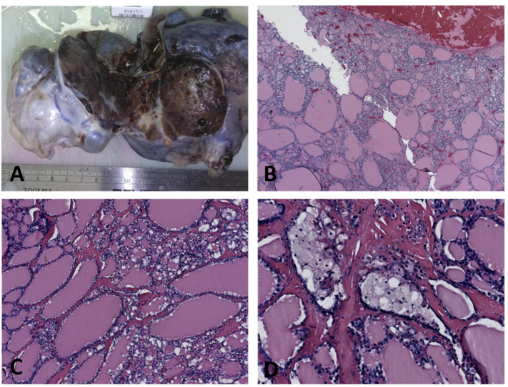 Figure 17