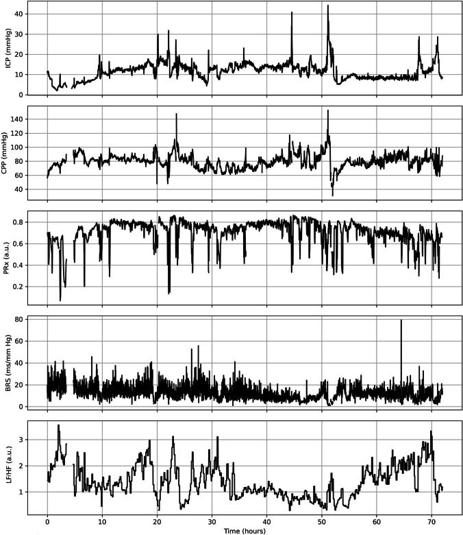 Fig. 2