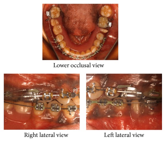 Figure 4