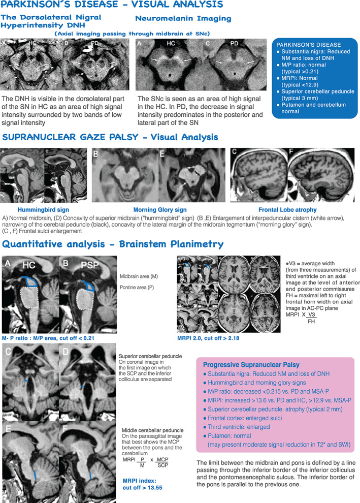 FIG 2