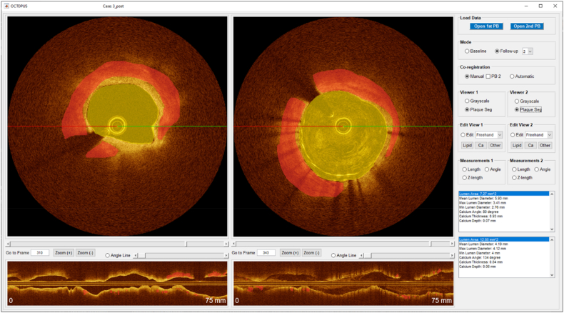 Fig. 3