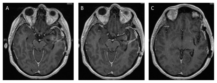 Fig. 7