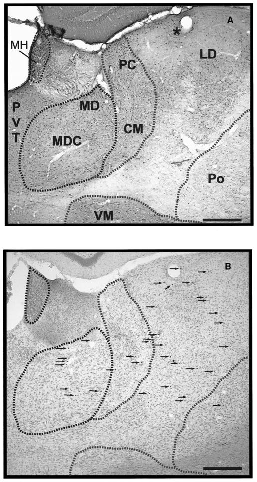 FIG. 5