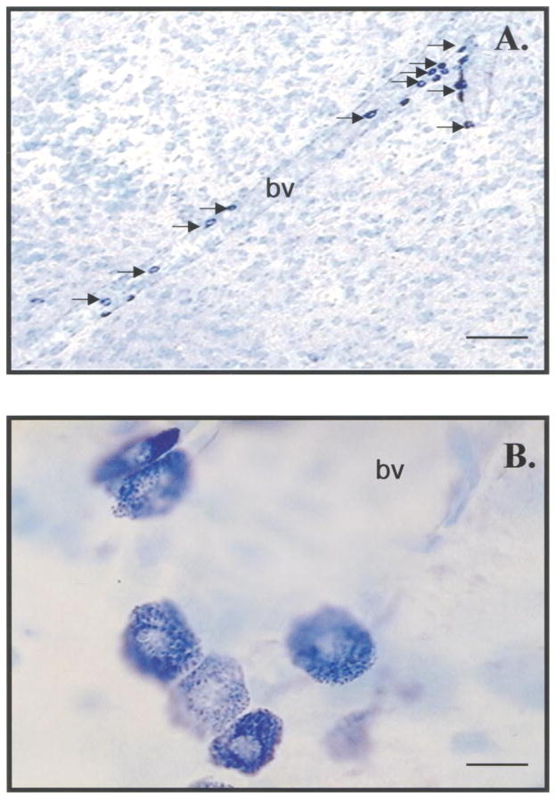 FIG. 1