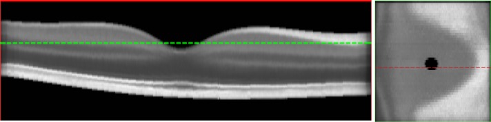 Fig. 3