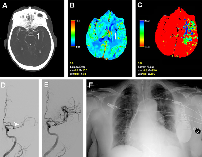 Fig 1