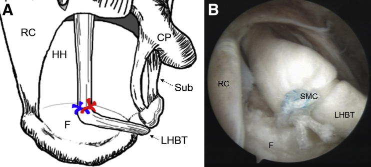 Fig 5