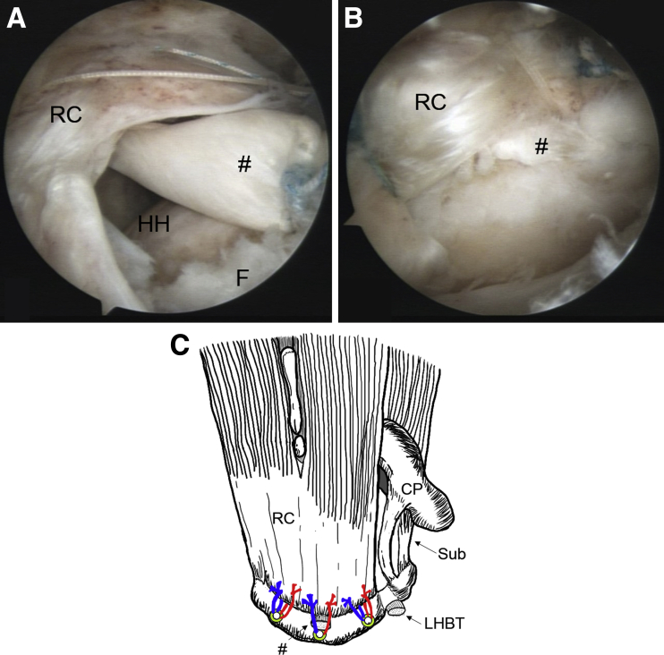 Fig 9