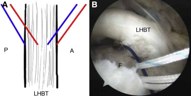 Fig 4