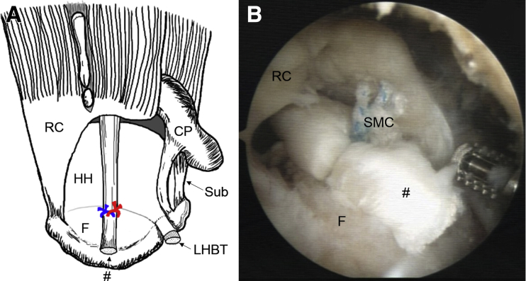 Fig 6