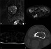 Fig. 2