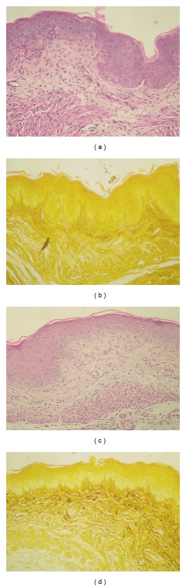 Figure 11