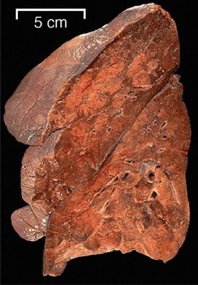FIGURAS 5-66 y 5-67