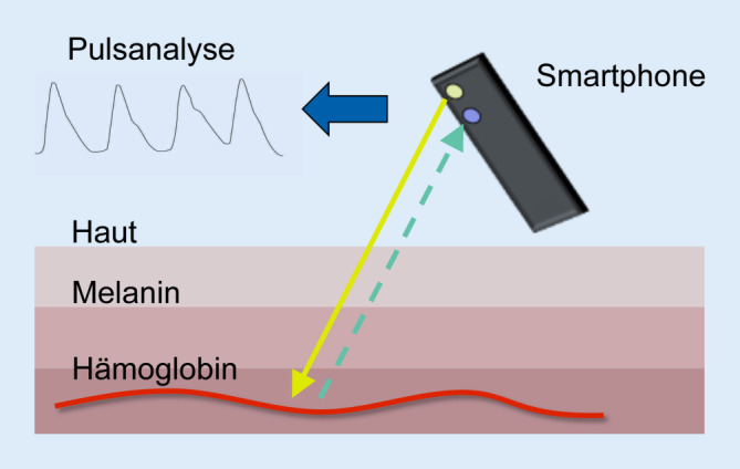 graphic file with name 399_2020_700_Fig1_HTML.jpg