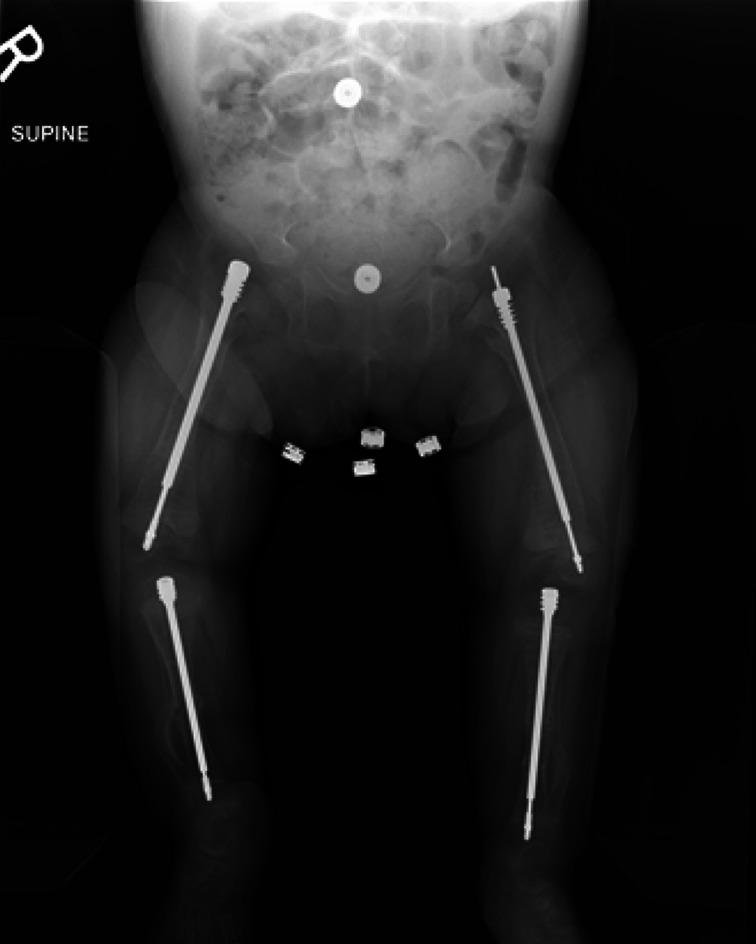 Fig. 2-C