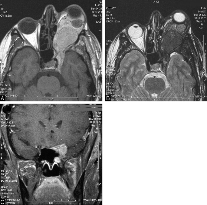 Fig 2.