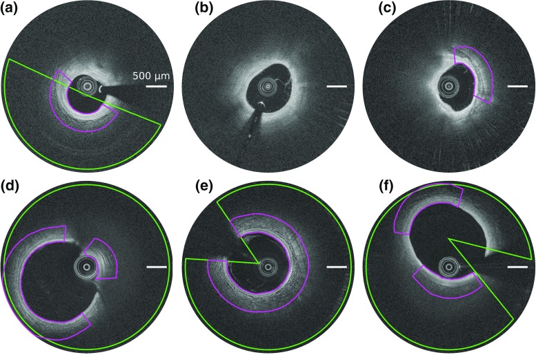 Fig. 6