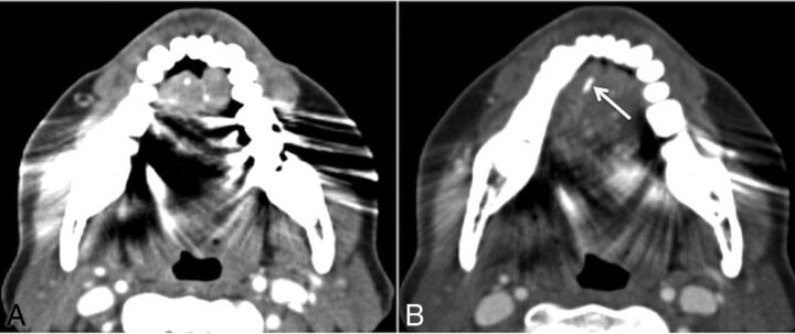 Fig 3.