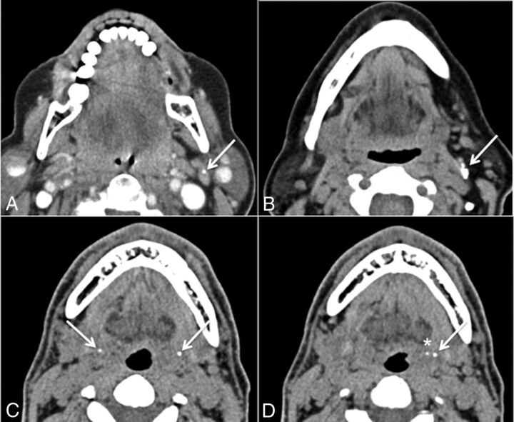 Fig 2.