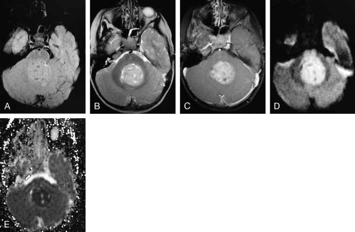 Fig 9.