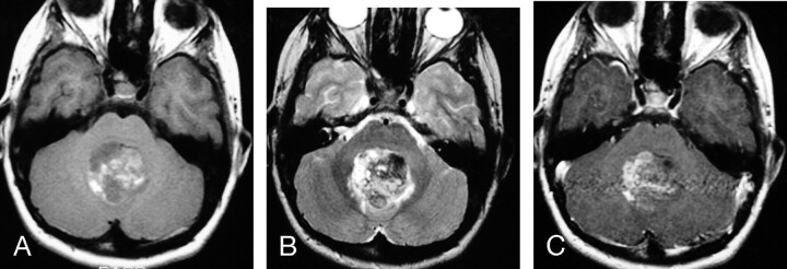 Fig 2.