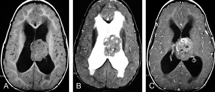 Fig 5.