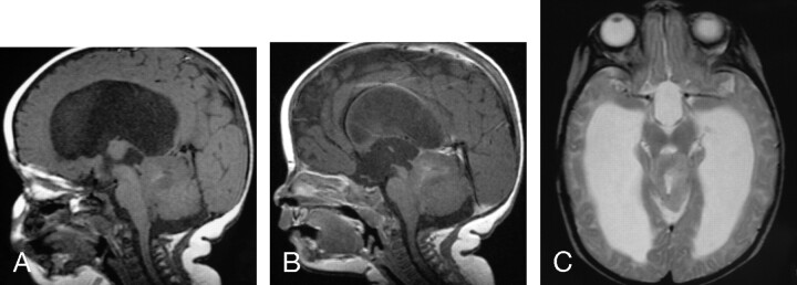 Fig 6.