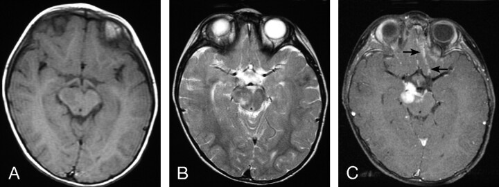 Fig 3.