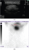 Fig. (2)