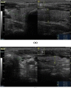 Fig. (1)