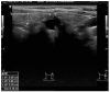 Fig. (4)