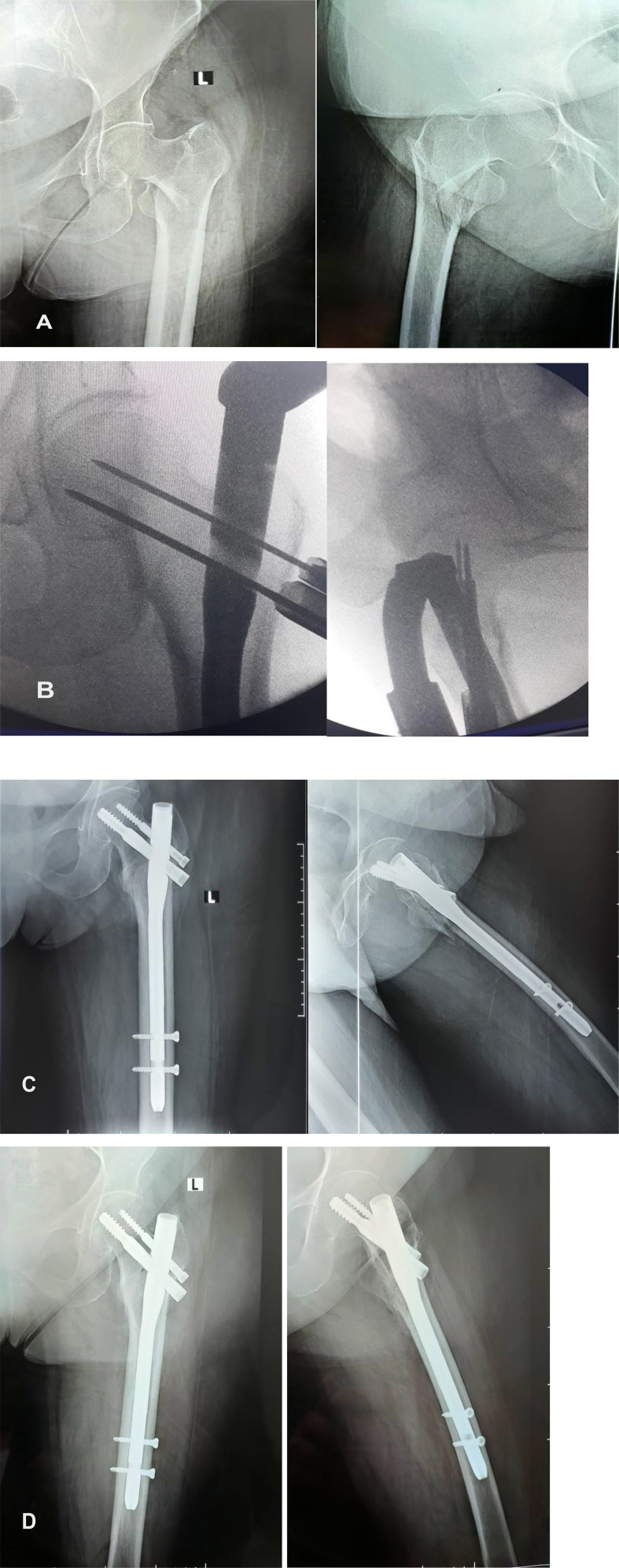 Figure 5