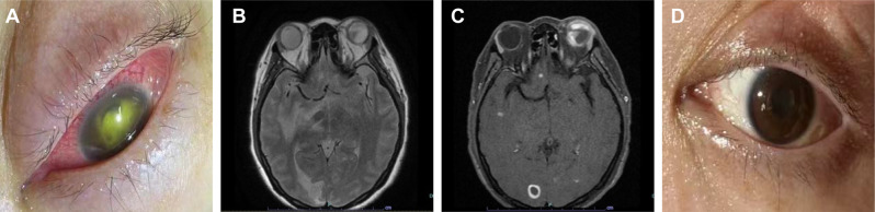 Fig. 4