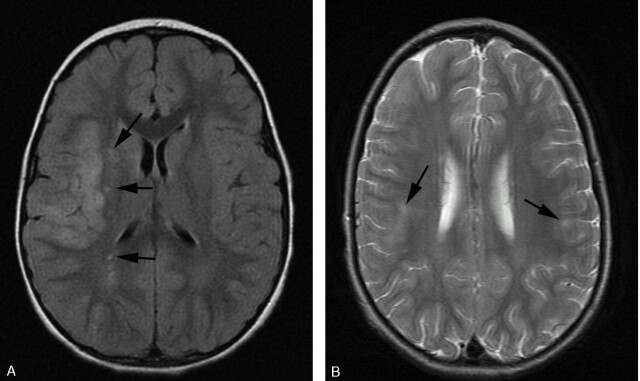 Fig 5.