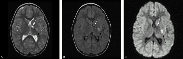 Fig 2.