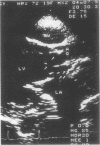 200