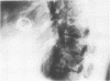 200
