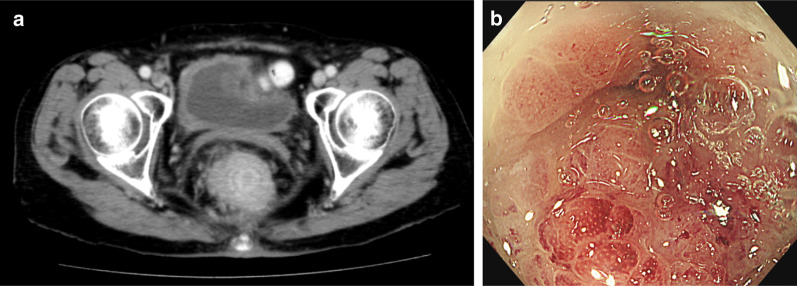 Fig. 1