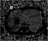 Fig. 13