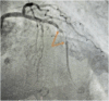 Fig. 42