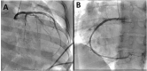 Fig. 35