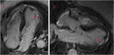 Fig. 52
