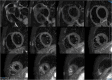 Fig. 18