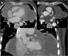 Fig. 54