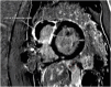 Fig. 29