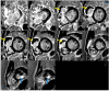 Fig. 28